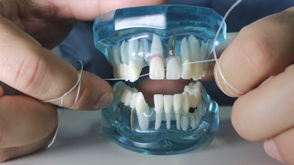 Fio Dental Demonstração no Molde