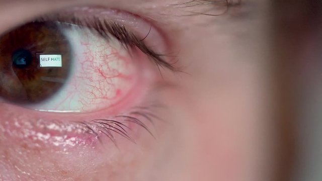 Macro shot of words SELF HATE reflected in Man's eye