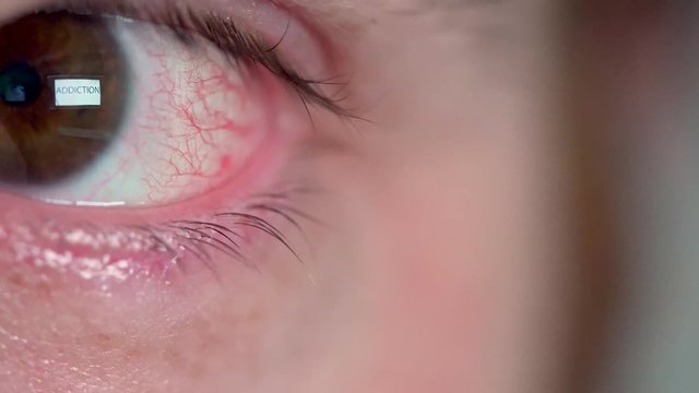 Word ADDICTION reflected in Man's eye close up