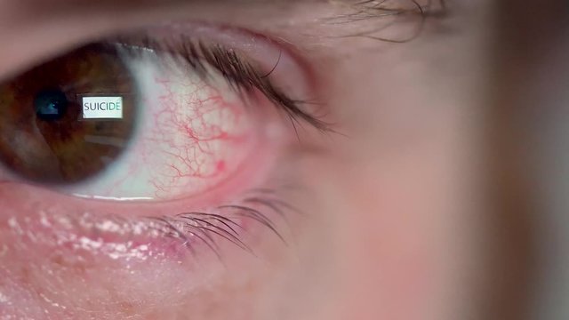 Word SUICIDE reflected in eye bloodshot macro close up
