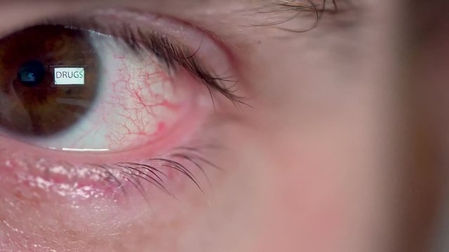 Reflection of the word DRUGS in bloodshot eye Macro