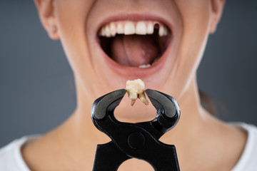 Woman Holding Broken Denture Using Pincers
