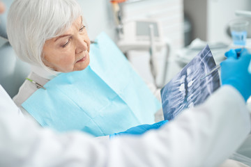 Elderly woman is looking at the X-ray - obrazy, fototapety, plakaty