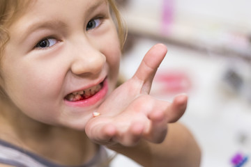 Cute little child has just lost the first milk tooth.