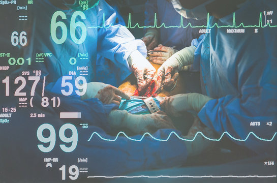 Medical Team Performing Surgical Operation in Modern Operating Room.  health care,insurance and life insurance,technology concept.