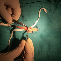 Baby´s umbilical cord vein ready to catheterize. Female doctor´s hand with gloves and baby...