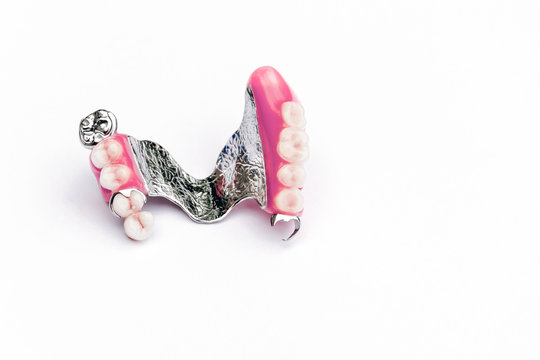 clasp prosthesis on the upper jaw. upper denture. false teeth. ceramic teeth. removable denture. White background