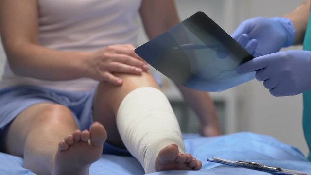 Traumatologist explaining x-ray results to patient with leg trauma, health care
