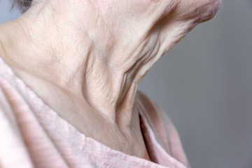 A flabby wrinkled excess skin on the neck of a senior woman close up