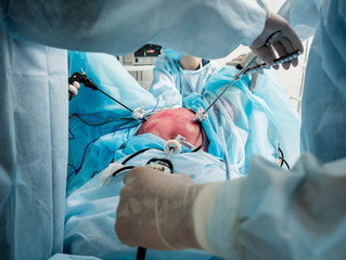 Process of gynecological surgery operation using laparoscopic equipment. Group of surgeons in...