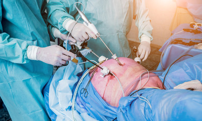 Process of gynecological surgery operation using laparoscopic equipment. Group of surgeons in...