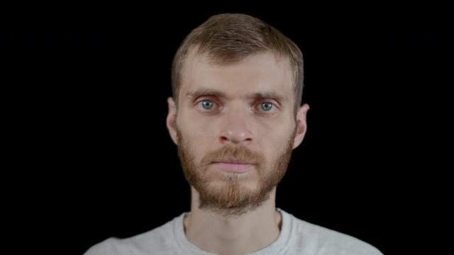 A man before and after of seven days of therapeutic dry fasting - without food and water, minus 9 kg