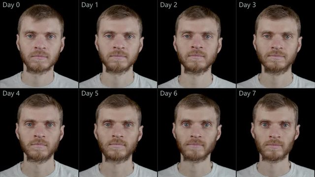 A man before and after of seven days of therapeutic dry fasting - without food and water, minus 9 kg