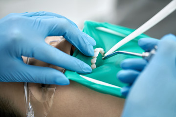 Pretty woman's teeth treatment in dental clinic