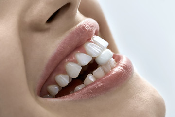 Closeup view at woman's mouth with perfect teeth