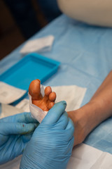 A surgeon or podiatrist performing a minor surgical procedure on the foot of a patient, cleaning, operating and applying a surgical dressing after. 