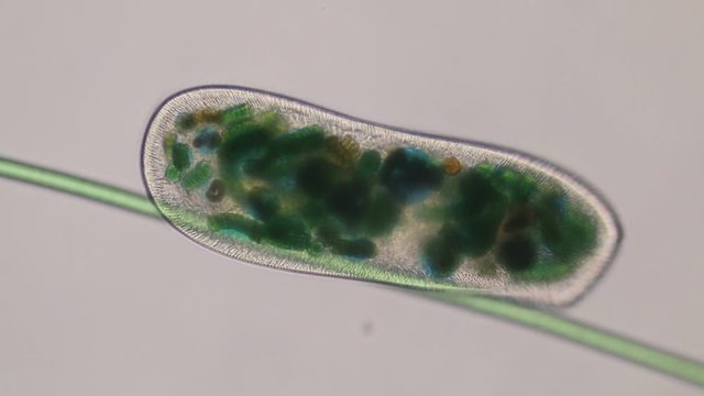 Frontonia sp. is a genus of free-living unicellular ciliate protists under the microscope.