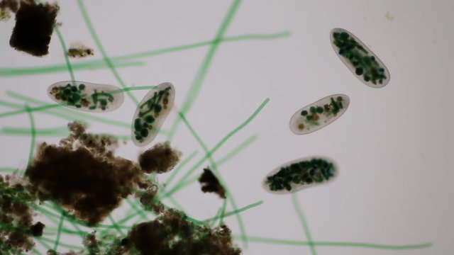 Frontonia sp. is a genus of free-living unicellular ciliate protists under the microscope.