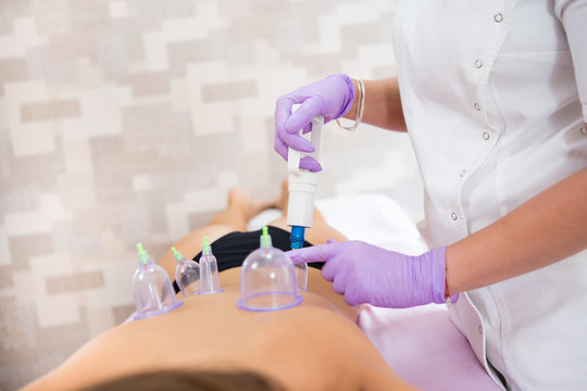 Young Woman Doctor In Purple Gloves Performs Therapy With Vacuum Glasses On The Back Of A Beautiful Young Woman.