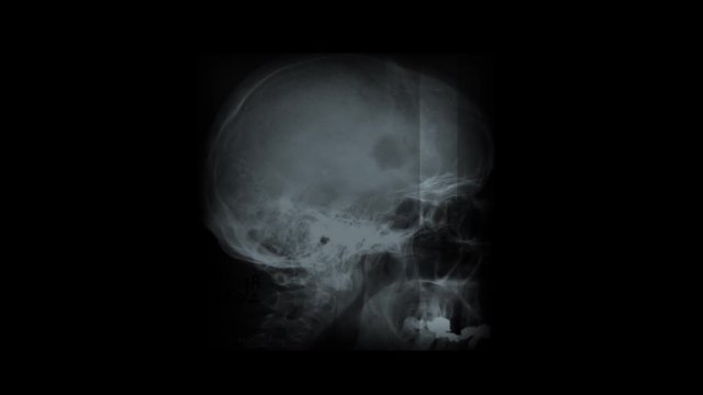 4k abstract animated x-ray background
