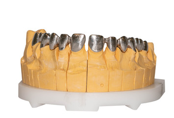 Frames of ceramic-metal bridge crowns on the stand of the articulator. The basis of ceramics of the upper jaw. Dental photo isolate on white. © Antonio