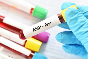 Blood sample tube for anti-Müllerian hormone or AMH test, evaluate of ovarian function and...