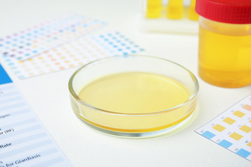 Petri dish with urine sample for analysis on white table