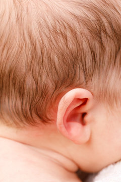 Hair on newborn babys ear known as Lanugo symptom