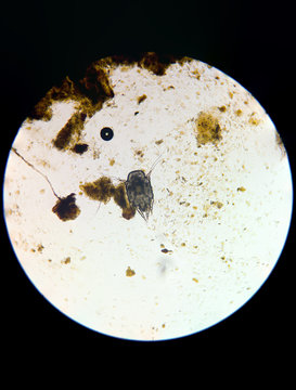 otodectes cynotis also known as ear mite. Taken from ear of homeless cat.