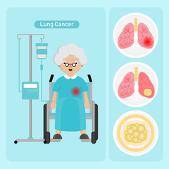 Senior woman Patient with Lung Cancer in cartoon style.