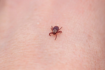dangerous little insect mite crawls on the skin of a person's hand on a walk in the Park