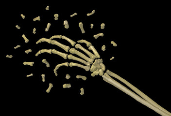 Skeleton Arm Bones, Small Bits