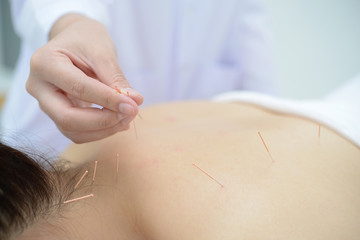 Closeup, patient getting acupuncture from acupuncturist at clinic for chinese medicine treatment.