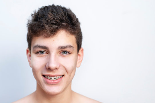 Portrait of a handsome young boy who genuinely smiles on a light background, with braces on his teeth for align his teeth. Dental concept