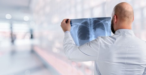 lung radiography concept. radiology doctor examining at chest x ray film of patient at hospital...
