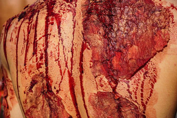 Traumatic injury patients with blood in the emergency room after the accident