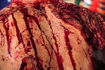 Traumatic injury patients with blood in the emergency room after the accident