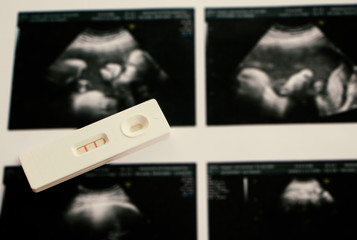 pregnancy test equipment that shows results of being pregnant