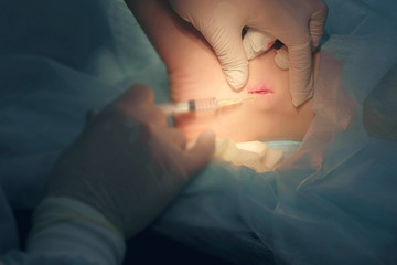 Surgeon man inputting drug for local anesthesia during surgery to sew up wound on leg, hands closeup. Infiltration anesthesia to removal ankle joint hygroma operation in hospital. One day surgery.