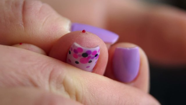 Close-up of a girl piercing his finger with a scarifier to check the level of glucose in the blood. Control diabetes at home with a glucometer. A drop of blood. Blood sampling for glucometer.