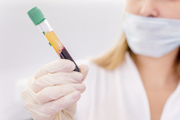 ?oung attractive doctor with mask on face in scrub and gloves holds in hand test tube with the...