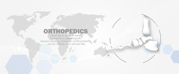 Medical orthopedic abstract background. Treatment for orthopedics traumatology of foot and ankle bones and joints injury. Medical presentation, hospital. Vector illustration	