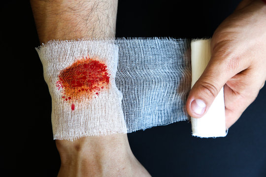 Man is putting the bandage on the wound. Bleeding injury.