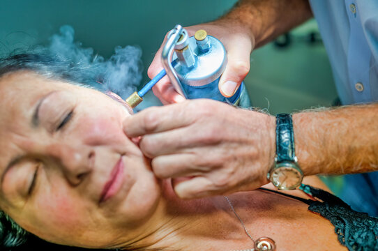 Close Up Of Female Receiving Local Cryotherapy Treatment To Her Face. Nitrogen Vapors Applied