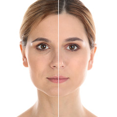 Woman before and after plastic surgery on white background