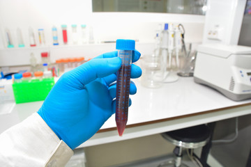 Clinical study of blood.