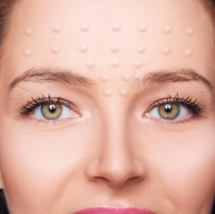 Obraz premium Beautiful woman with marks from biorevitalization procedure.