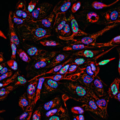 Fluorescent Imaging immunofluorescence of cancer cells growing in 2D with nuclei in blue, cytoplasm in red and DNA damage foci in green - 299642086