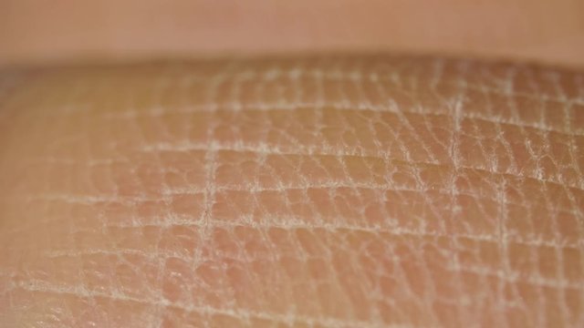 White detailed caucasian human skin on hand fingers closeup in macro