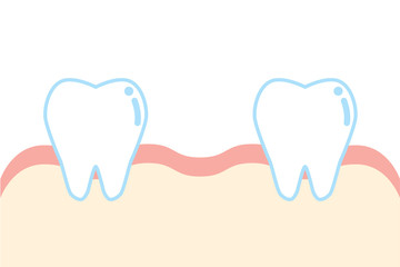 抜歯した歯のイラスト Illustration of extraction, removal of tooth - obrazy, fototapety, plakaty